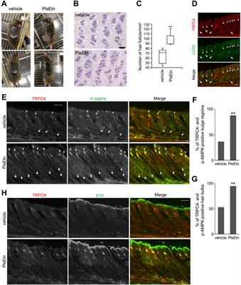 Transient Ca2+ entry by plasmalogen-mediated activation of receptor potential cation channel promotes AMPK activity